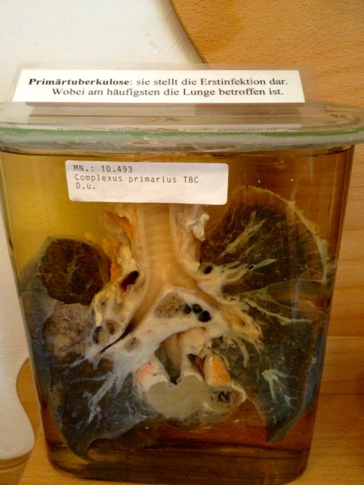 Narrenturm (Tower of Fools) (6).jpg